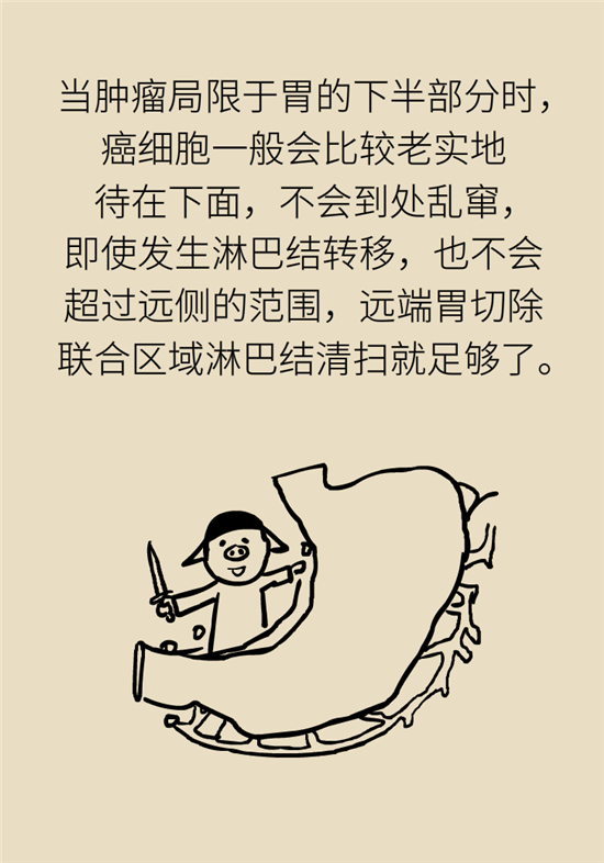 胃癌手術(shù)一定要全切胃？專家：視情況而定