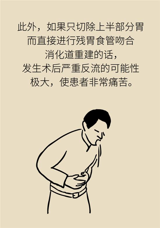 胃癌手術(shù)一定要全切胃？專家：視情況而定