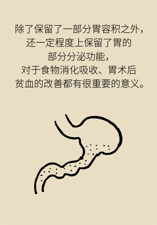 胃癌手術(shù)一定要全切胃？專家：視情況而定
