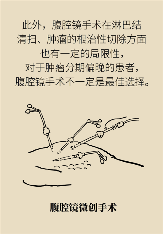 胃癌手術(shù)一定要全切胃？專家：視情況而定