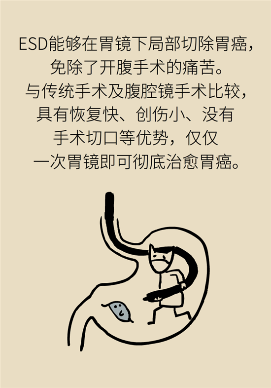 胃癌手術(shù)一定要全切胃？專家：視情況而定