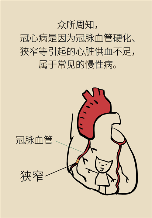 為什么裝完支架猝死風險還增高了？都是因為這些壞習慣