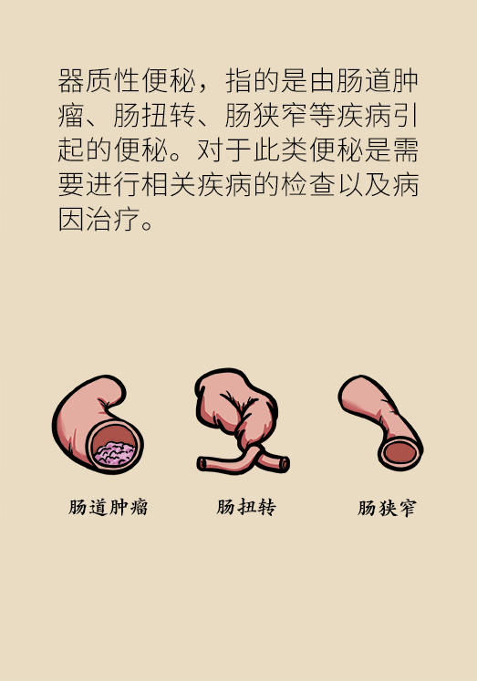 香蕉真的會緩解便秘嗎？