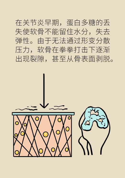 人老關(guān)節(jié)也會(huì)老嗎？