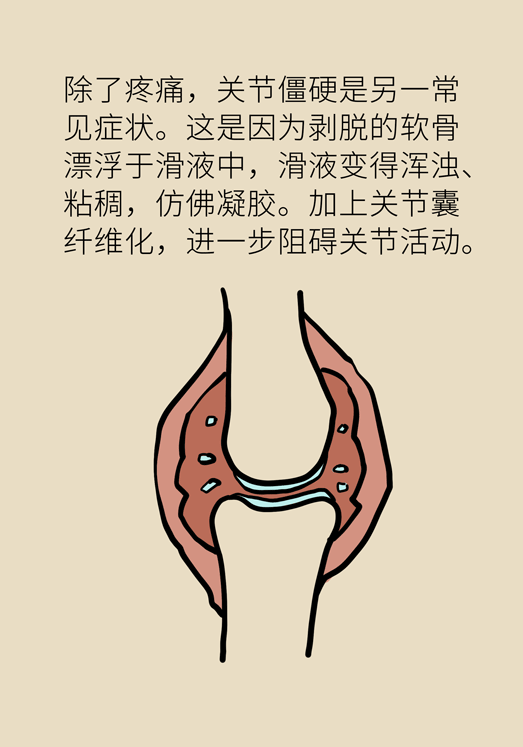 人老關(guān)節(jié)也會(huì)老嗎？