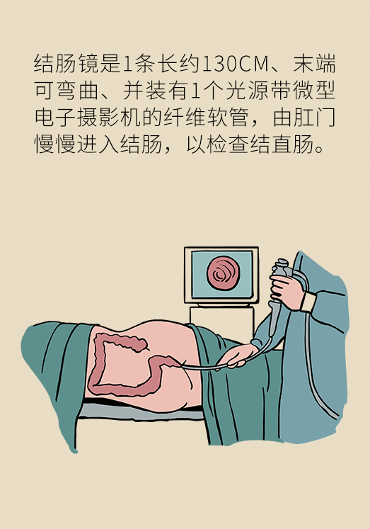 患潰瘍性結(jié)腸炎該怎么辦？結(jié)腸鏡檢查了解一下