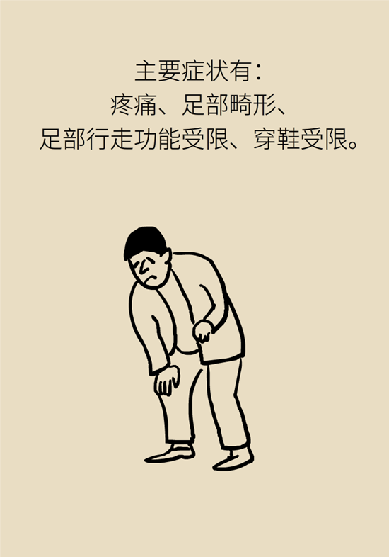 走幾百米路就疼得不行了？可能患上了平足癥