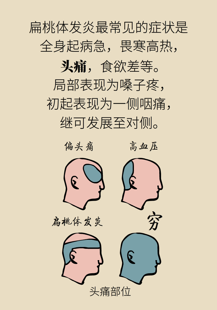 單側(cè)扁桃體腫大更兇險(xiǎn)！謹(jǐn)防惡性腫瘤