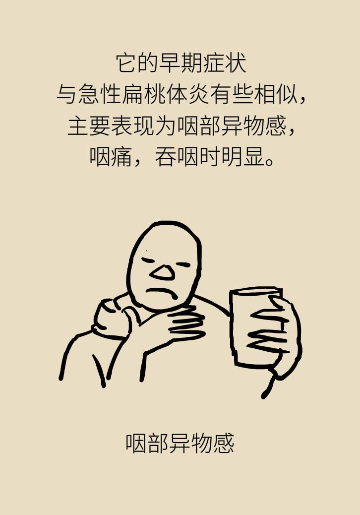 單側(cè)扁桃體腫大更兇險(xiǎn)！謹(jǐn)防惡性腫瘤