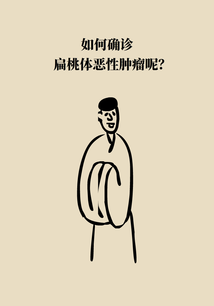 單側(cè)扁桃體腫大更兇險(xiǎn)！謹(jǐn)防惡性腫瘤