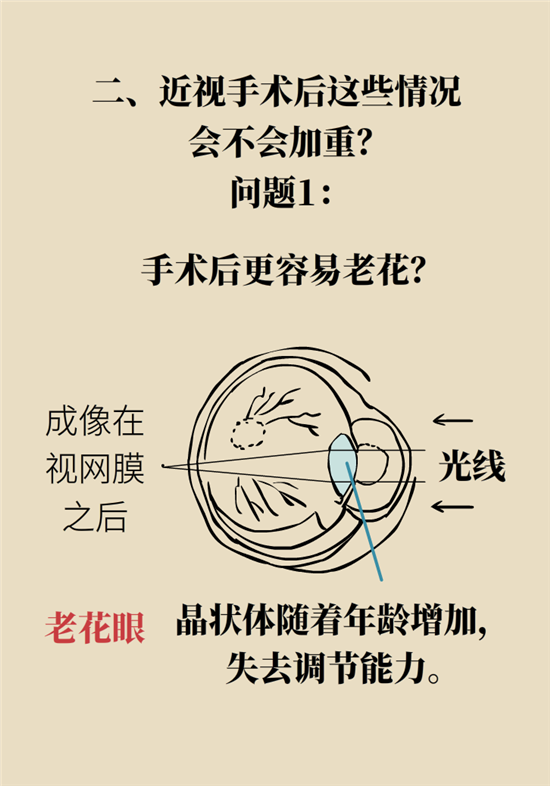 近視科普動漫制作 近視