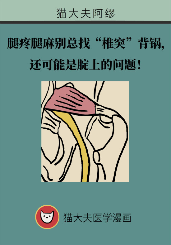 梨狀肌綜合征 梨狀肌綜合征