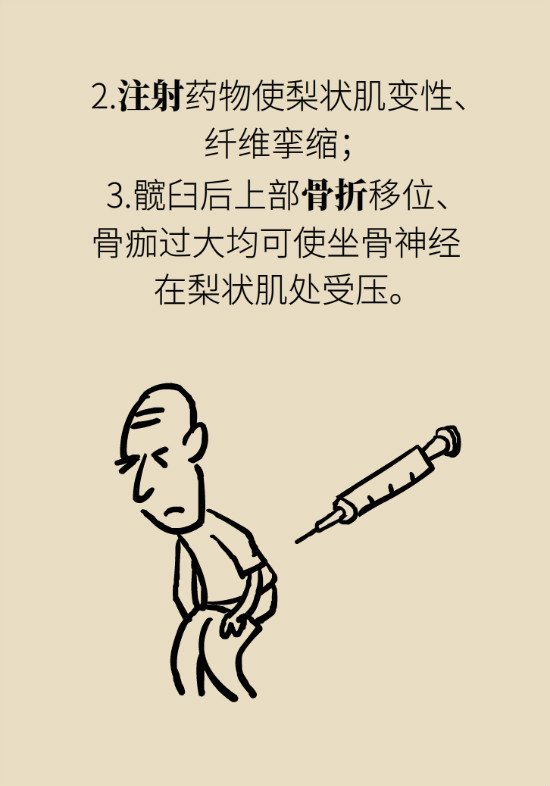 梨狀肌綜合征 梨狀肌綜合征