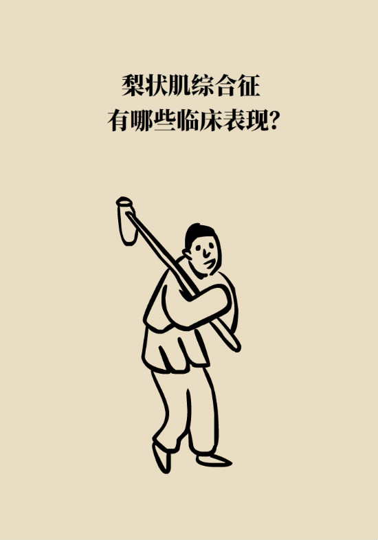 梨狀肌綜合征 梨狀肌綜合征