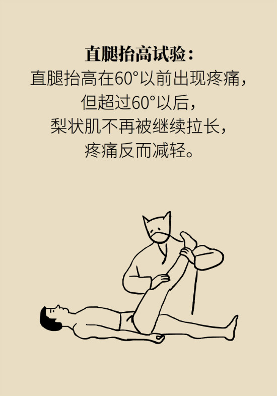 梨狀肌綜合征 梨狀肌綜合征