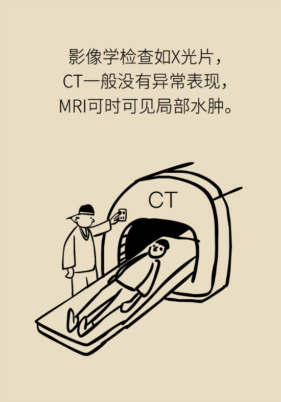 梨狀肌綜合征 梨狀肌綜合征
