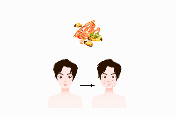 皮膚病科普動漫制作 皮膚病科普動漫制作