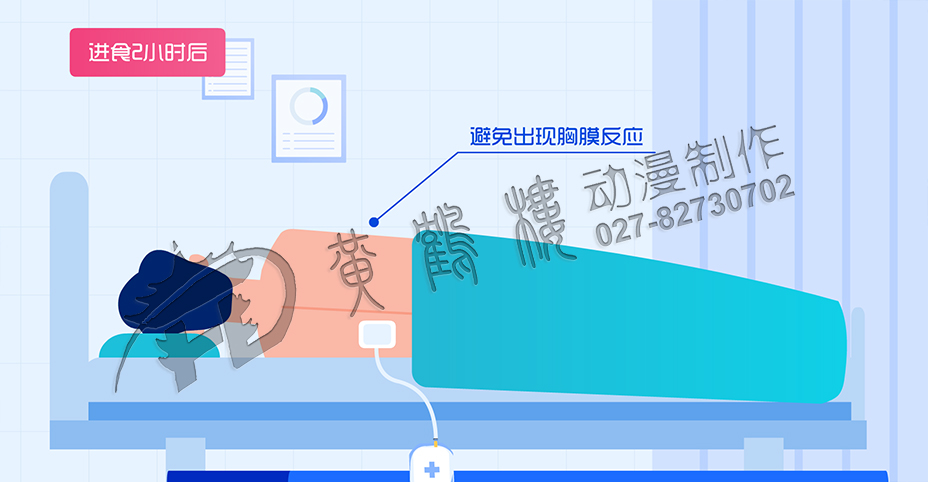 醫(yī)學(xué)動畫制作公司 醫(yī)學(xué)動畫制作公司