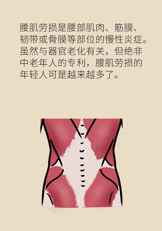 久坐久站致腰肌勞損？六招教你戰(zhàn)勝腰痛