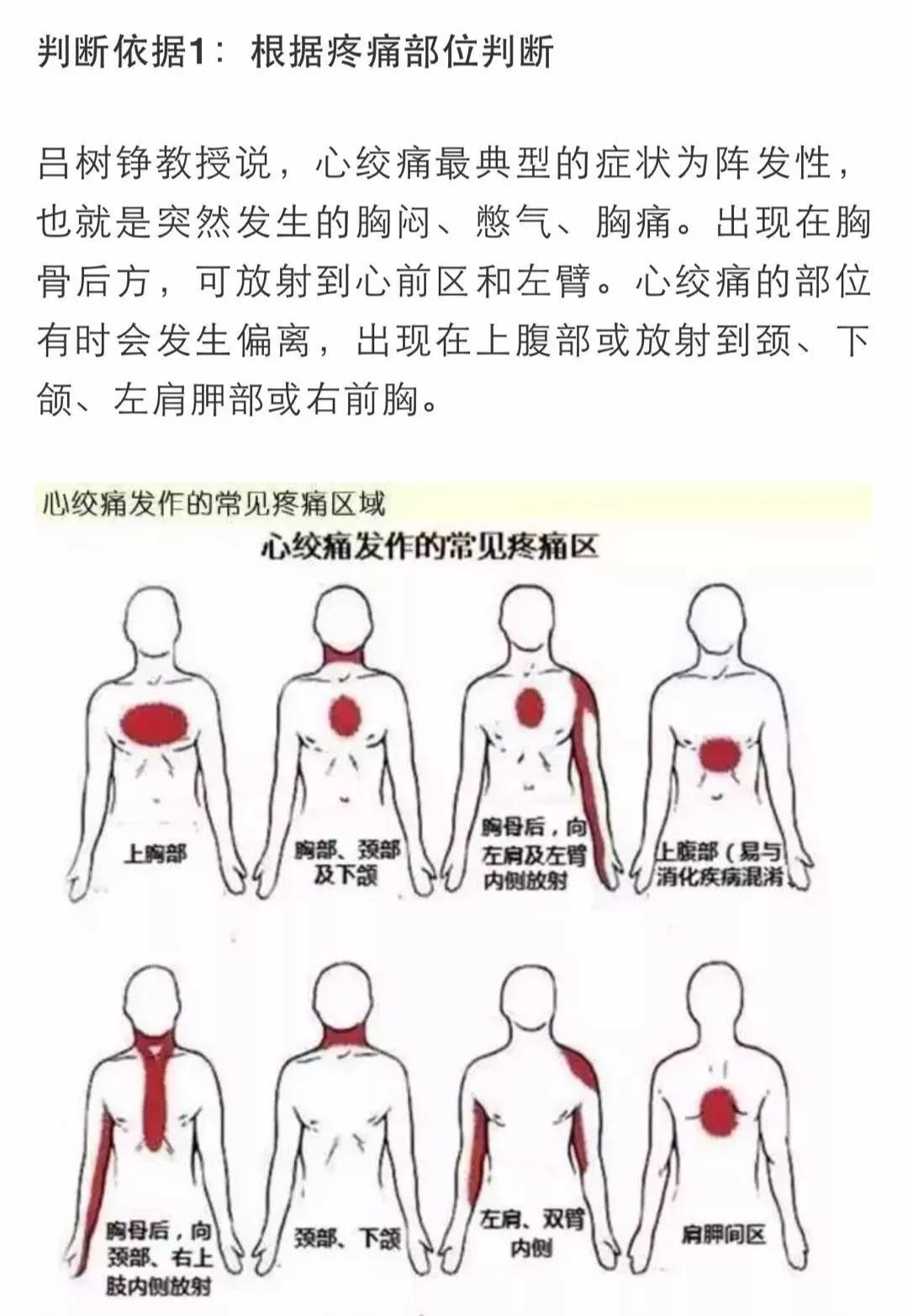 心梗有前兆！心臟發(fā)出的警報你在意了嗎？