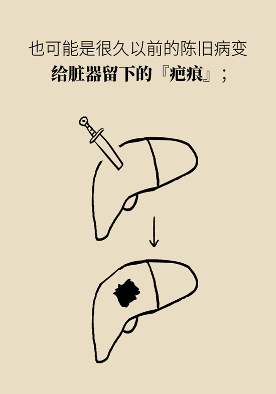 癌癥科普動(dòng)漫