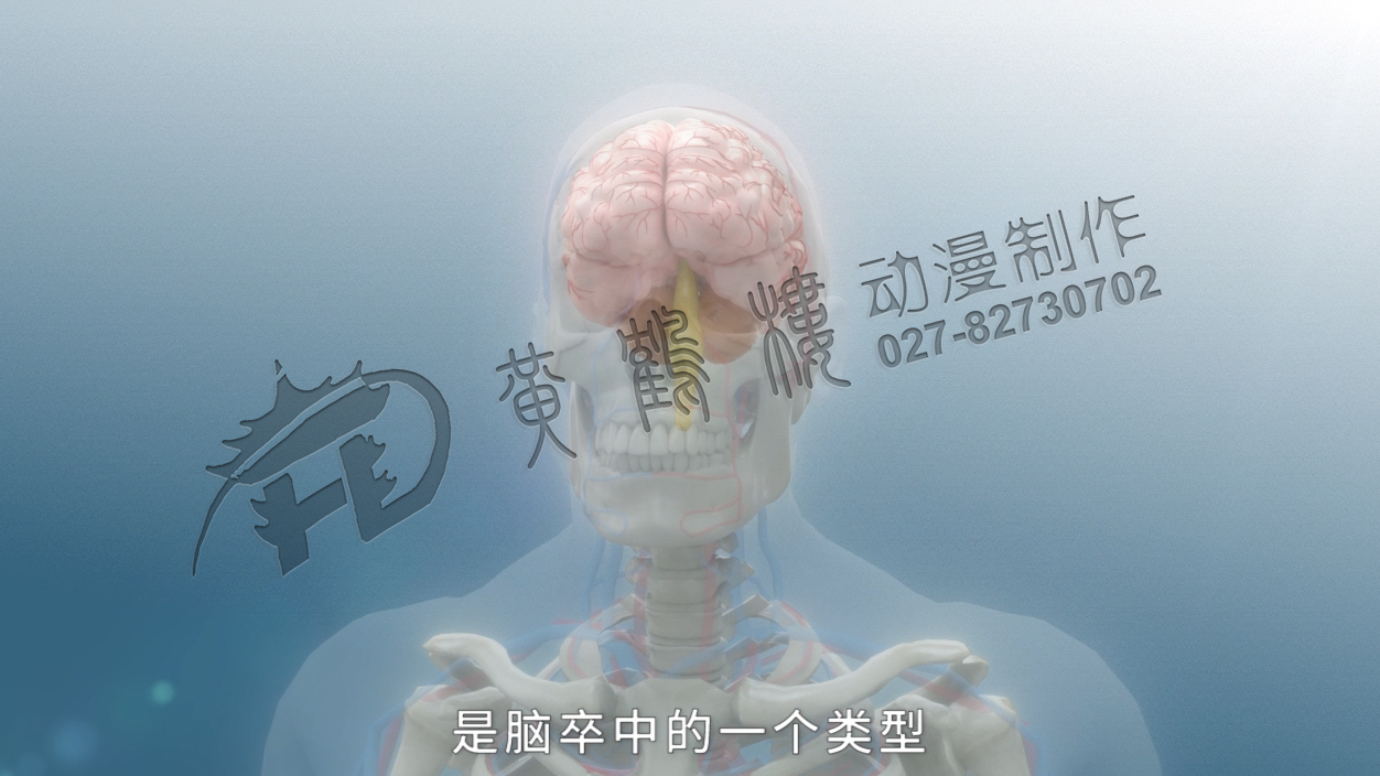 《缺血性腦卒中》三維醫(yī)療科普動畫宣傳片 《缺血性腦卒中》三維醫(yī)療科普動畫宣傳片