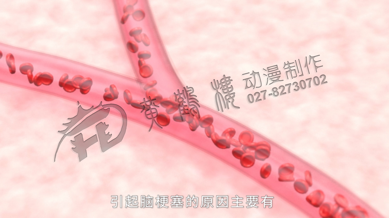 醫(yī)療動畫視頻制作公司 醫(yī)療動畫視頻制作公司