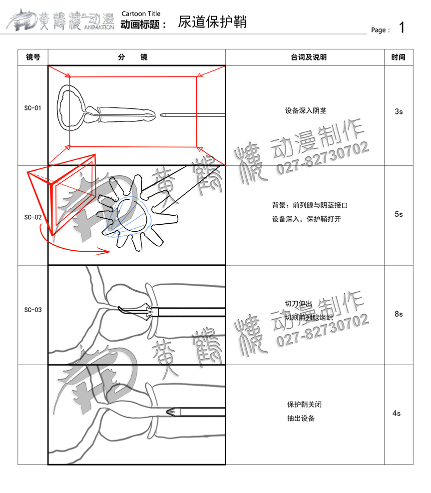 尿道保護鞘分鏡頭設(shè)計 尿道保護鞘分鏡頭設(shè)計