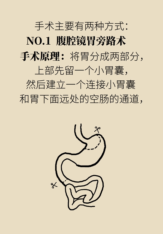 減肥醫(yī)學知識科普