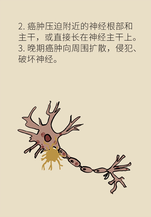 癌癥醫(yī)學知識科普動漫制作