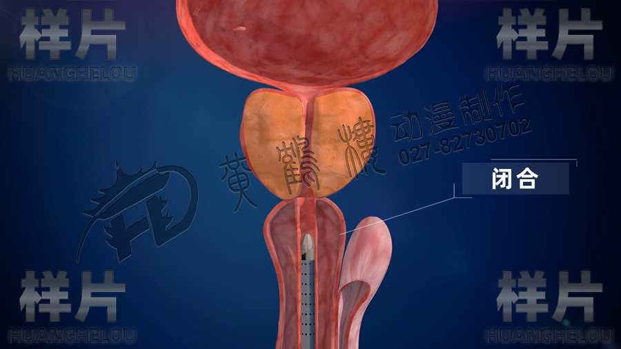 醫(yī)療器械產(chǎn)品動(dòng)畫制作.jpg 醫(yī)療器械產(chǎn)品動(dòng)畫制作.jpg