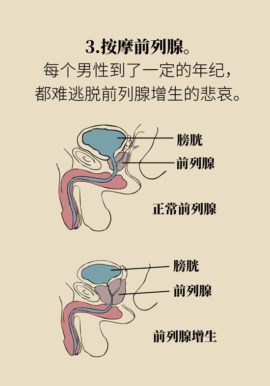 怎么做可以預防痔瘡呢？按摩前列腺、鍛煉盆底肌
