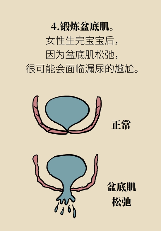 怎么做可以預防痔瘡呢？按摩前列腺、鍛煉盆底肌